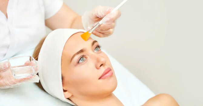 Chemical Peels